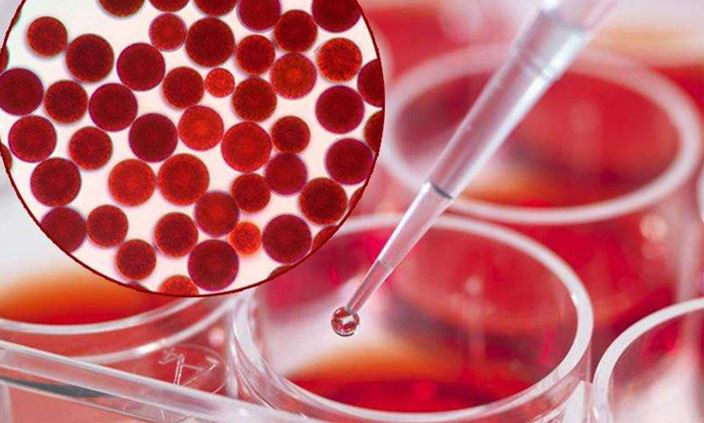 What is Astaxanthin ? What are the extraction sources of astaxanthin ?